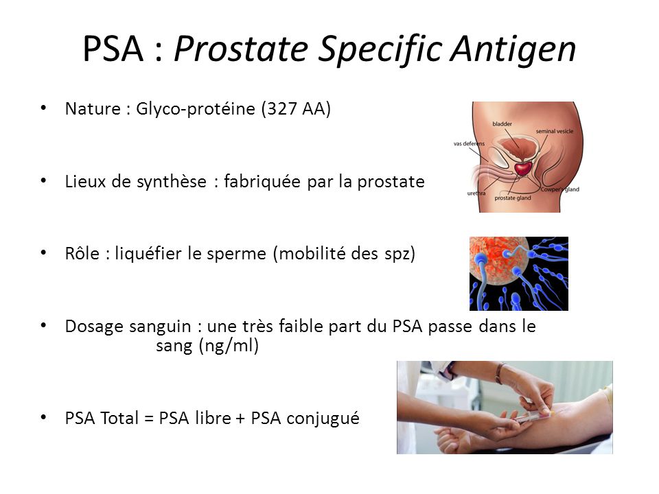 What is free prostate specific antigen